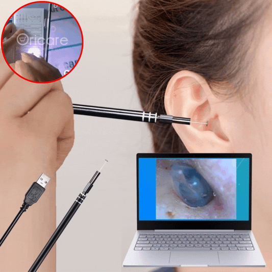 3-en-1 Orelpurigilo kun Fotilo 