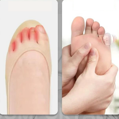 Frictuvo™ | Schützt mühelos deine Zehen (10+10 GRATIS)