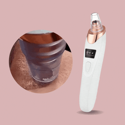 SkinSpa™ Forigilo de Nigraj Punktoj